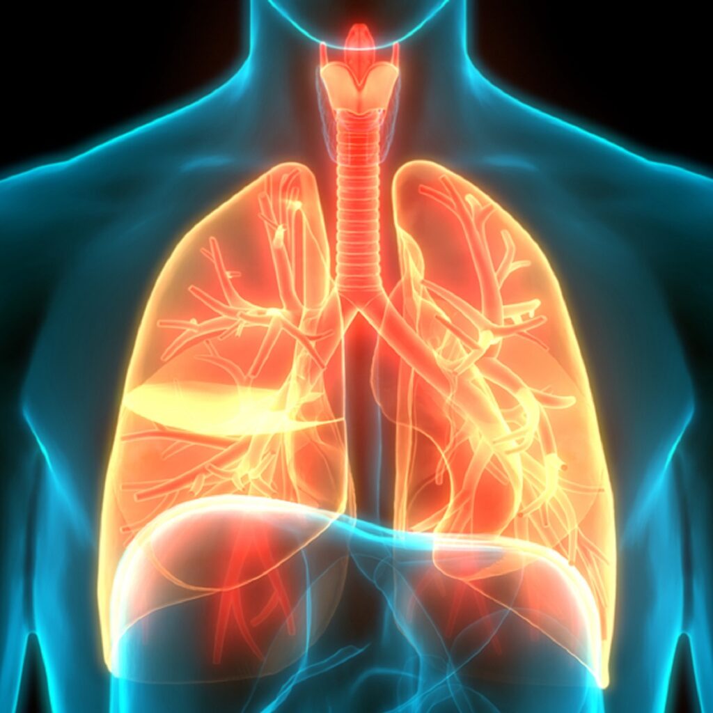 unit-3-chronic-bronchitis-b-arm-learning