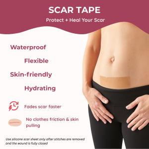 scar sheet